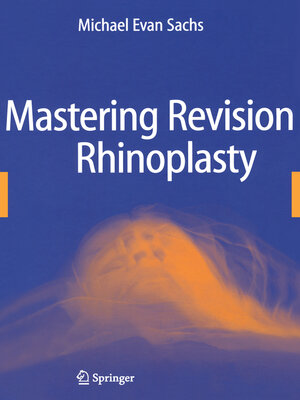 cover image of Mastering Revision Rhinoplasty